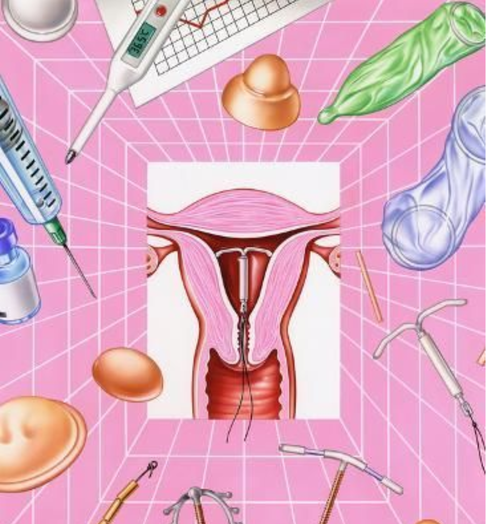 Your contraception FAQs answered